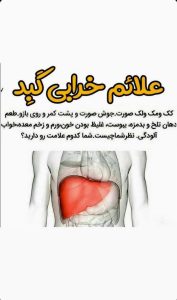 علائم کبد چرب